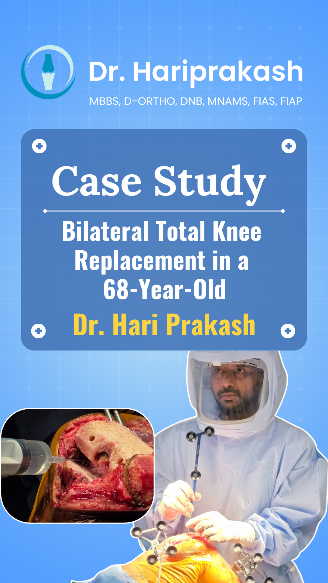 Watch Case Study